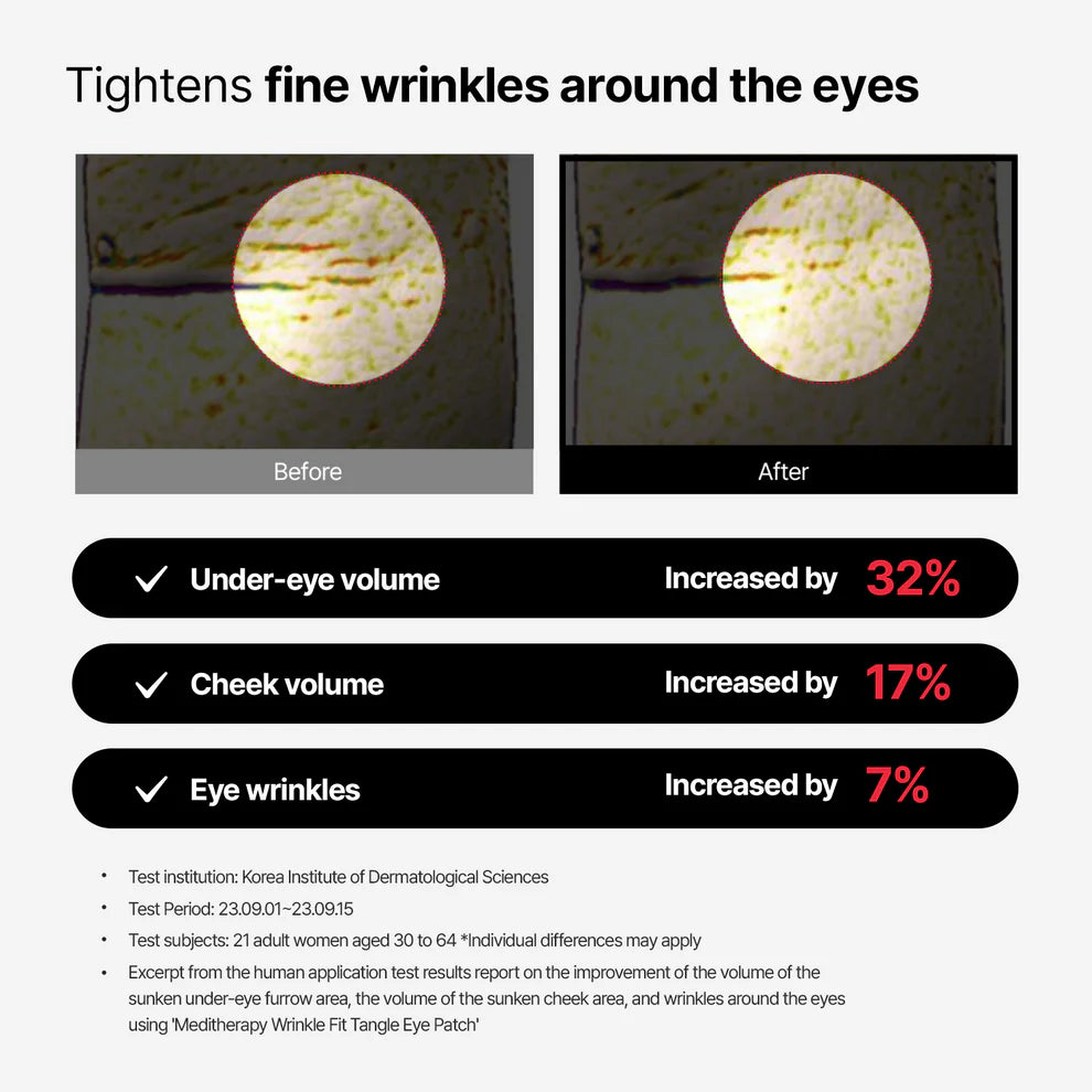 [READY STOCK] MEDITHERAPY Collagen Wrinkle-fit Tangle Eye Patch | 4 Pairs