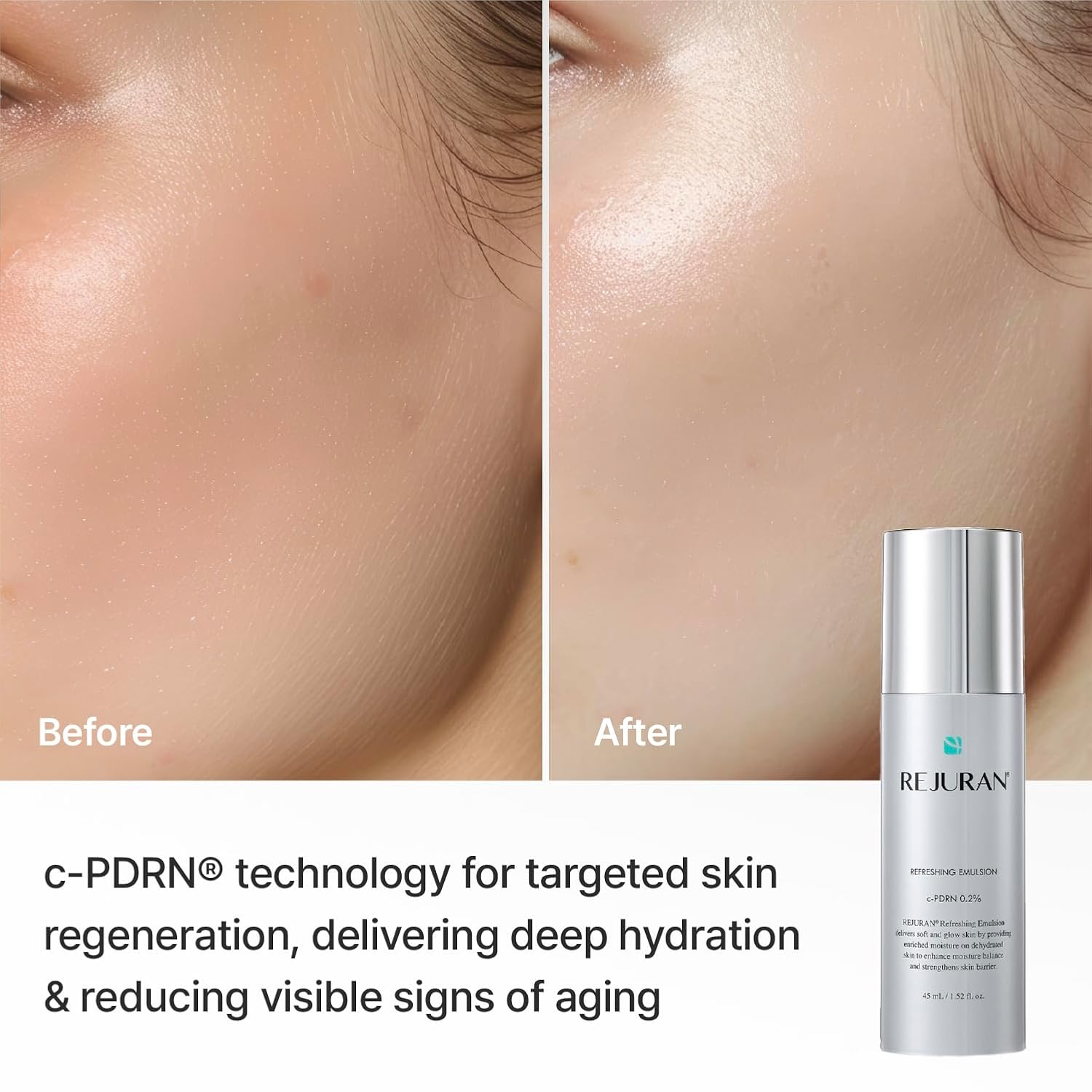 REJURAN Refreshing Emulsion | 45ml