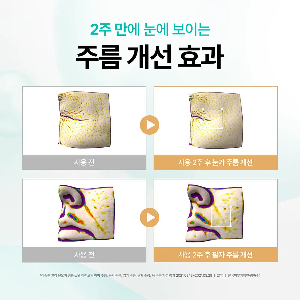 REJURAN Turnover Ampoule Dual Effect | 10ml+10ml+Free Sample